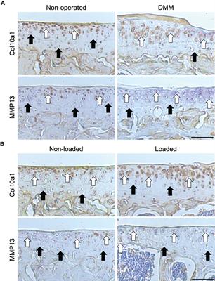 Characterisation of Growth Plate Dynamics in Murine Models of Osteoarthritis